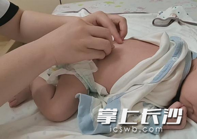 医生为宝宝做推拿,调整脏腑,促进气血运行。均为长沙晚报通讯员 林探宇 供图 医生为宝宝做推拿,调整脏腑,促进气血运行。均为长沙晚报通讯员 林探宇 供图